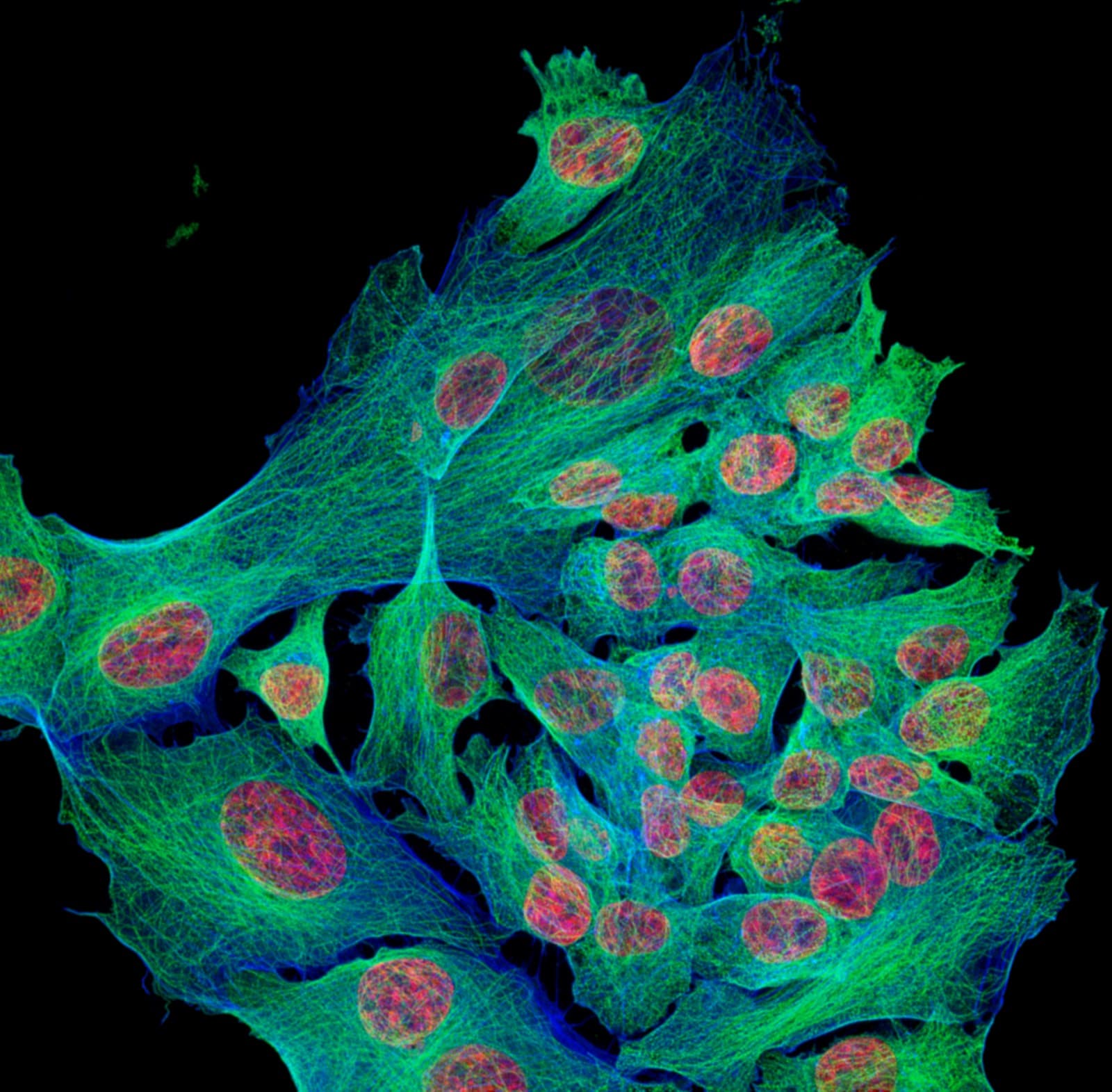 Fluorescence micrograph of osteosarcoma cancer cells with stained actin, microtubules, and nuclei