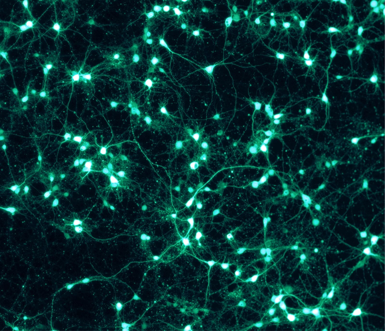 Fluorescence microscopy of GFP-labeled neurons and neural networks