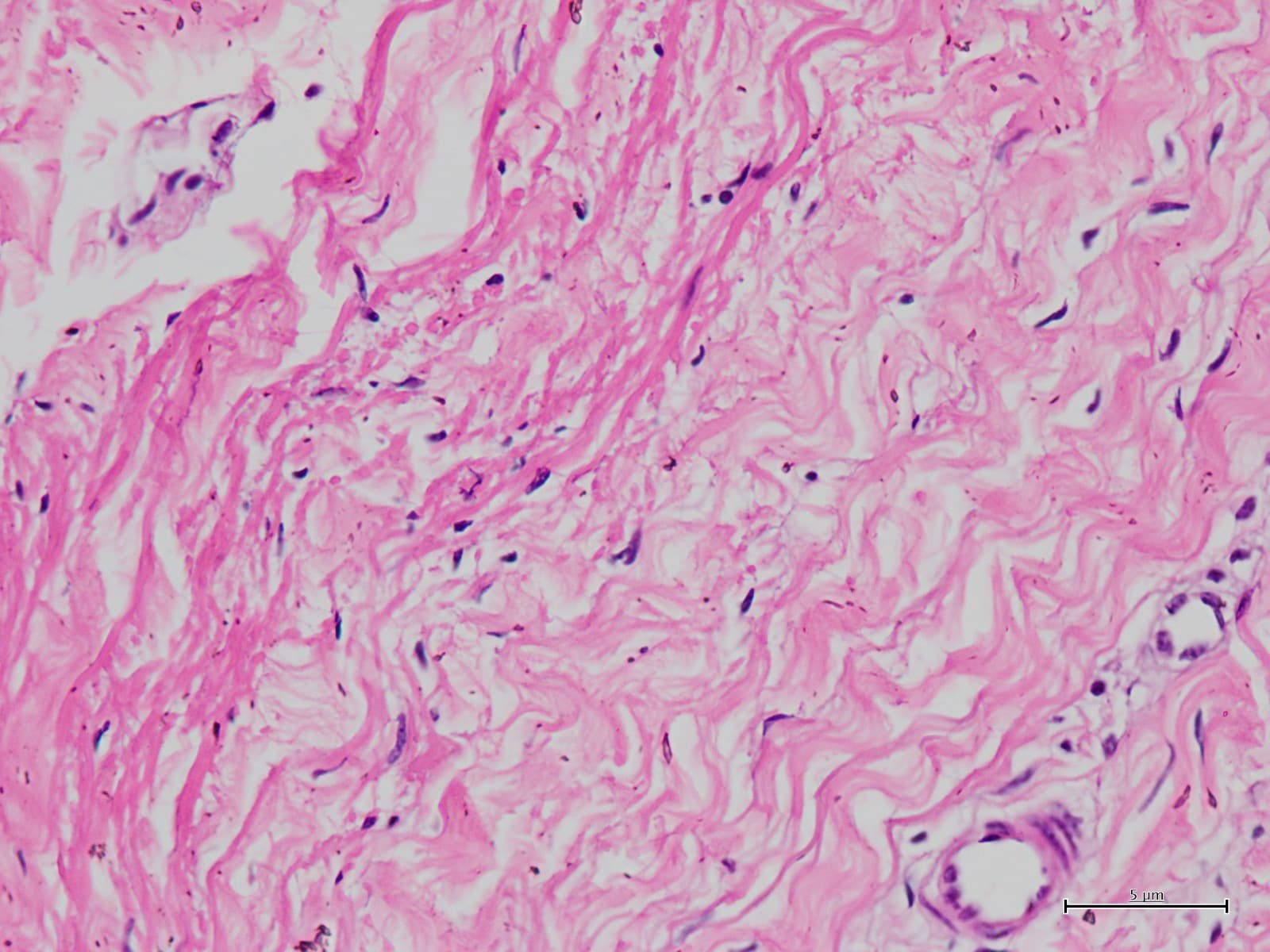 Hematoxylin and eosin stained tissue section viewed under the microscope in histopathology